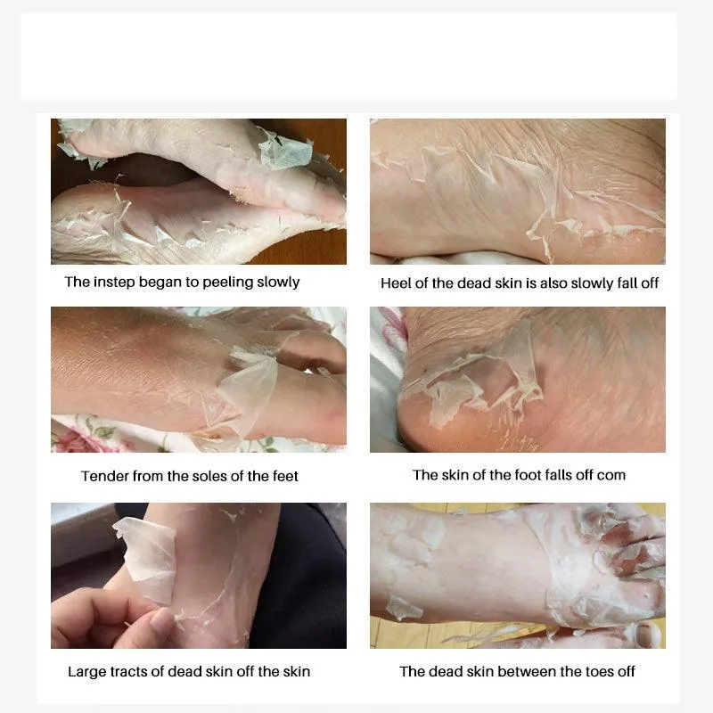 BABY FEET — FOOT PEEL MASK