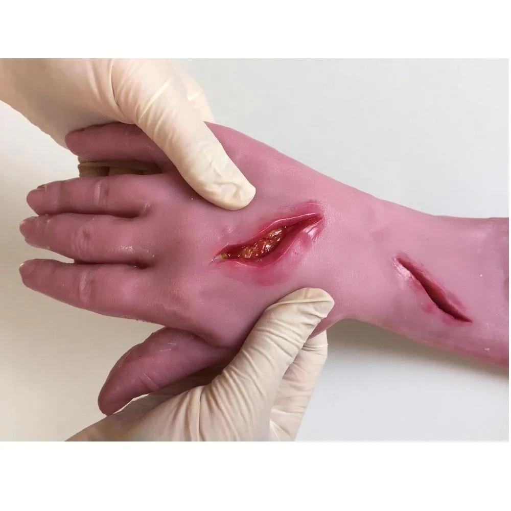 Suture Glove Simulator